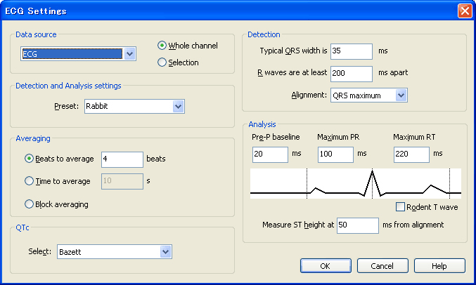 ECG Settings ダイアログ